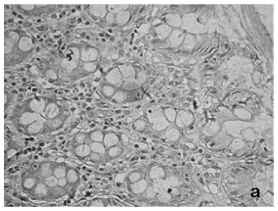 The application of kpna2 gene and the application of siRNA to inhibit the expression of kpna2 gene