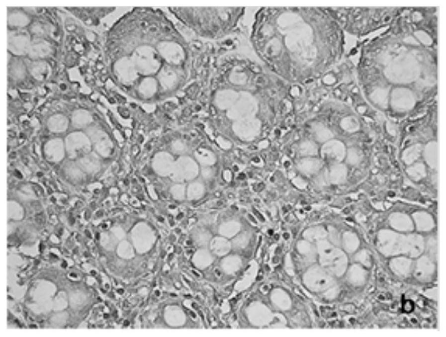 The application of kpna2 gene and the application of siRNA to inhibit the expression of kpna2 gene