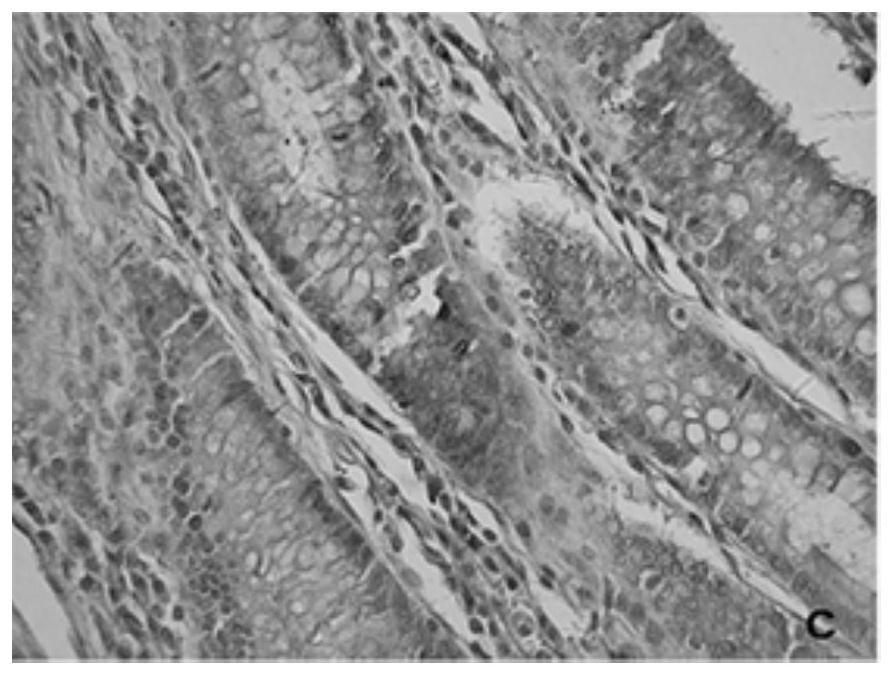 The application of kpna2 gene and the application of siRNA to inhibit the expression of kpna2 gene