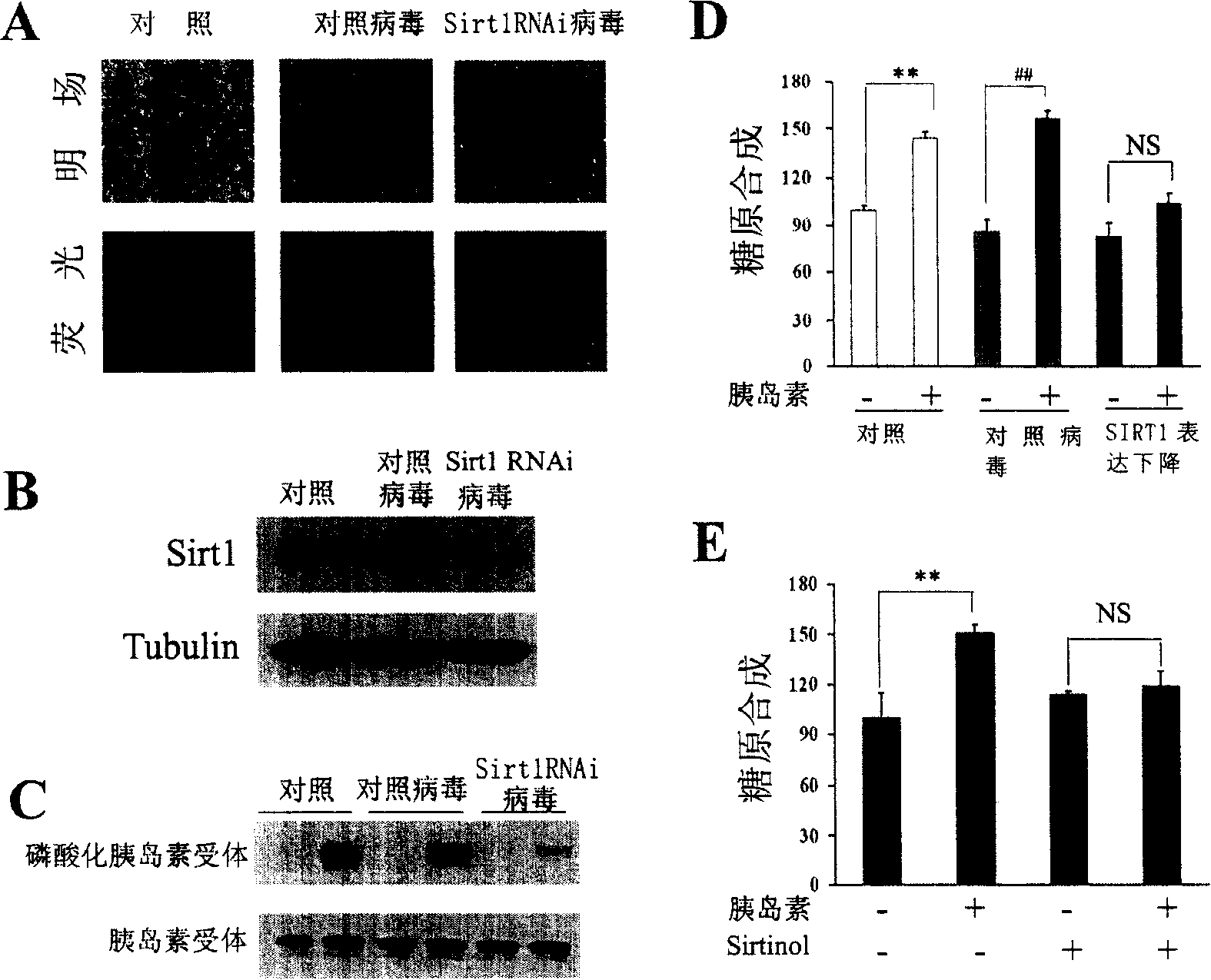 Method and composition for increasing insulin sensibility