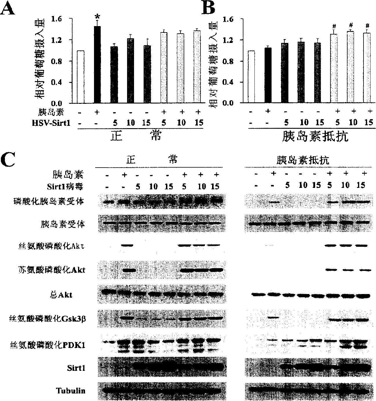 Method and composition for increasing insulin sensibility