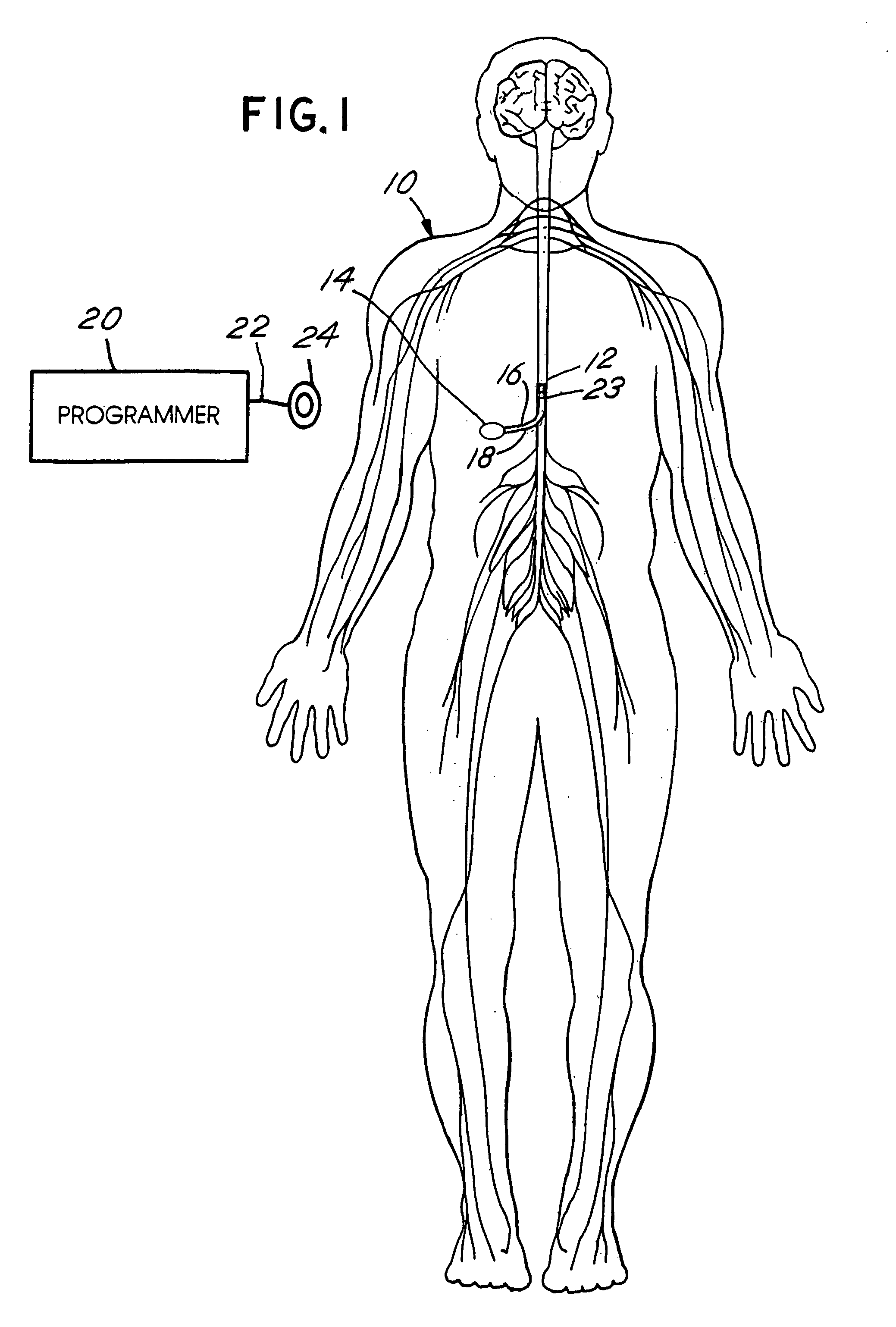 Techniques for positioning therapy delivery elements within a spinal cord or brain