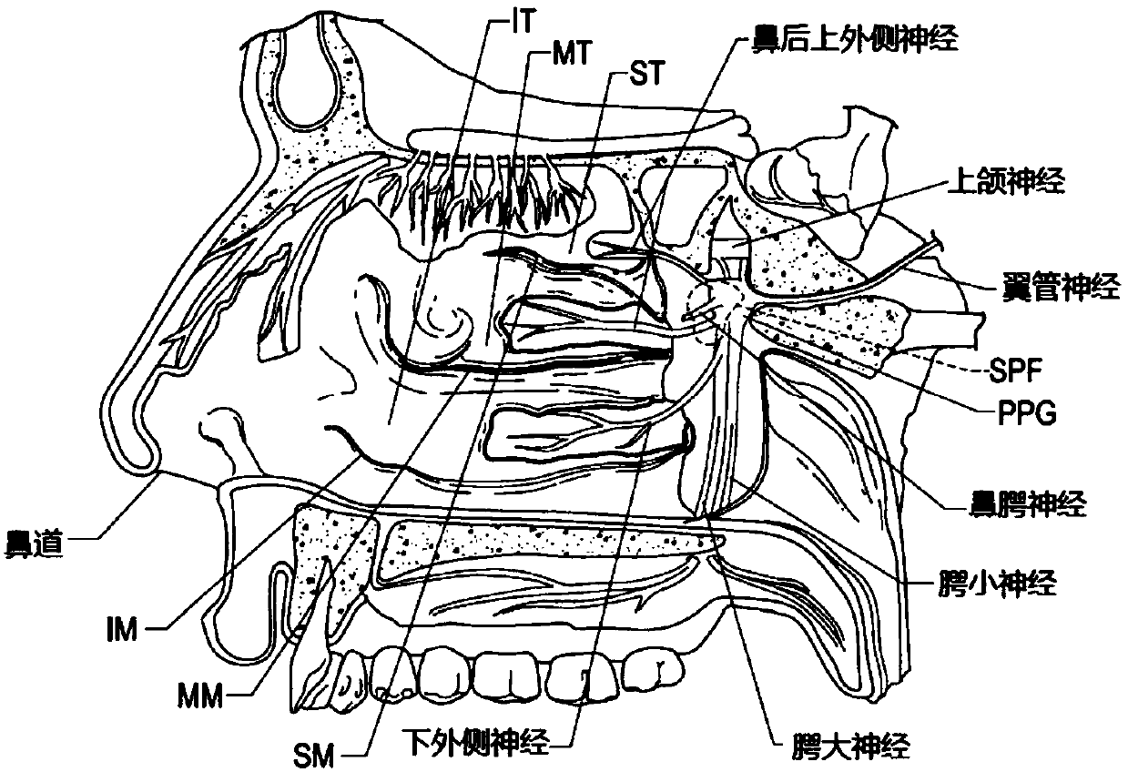 Devices for therapeutic nasal neuromodulation and associated methods and systems