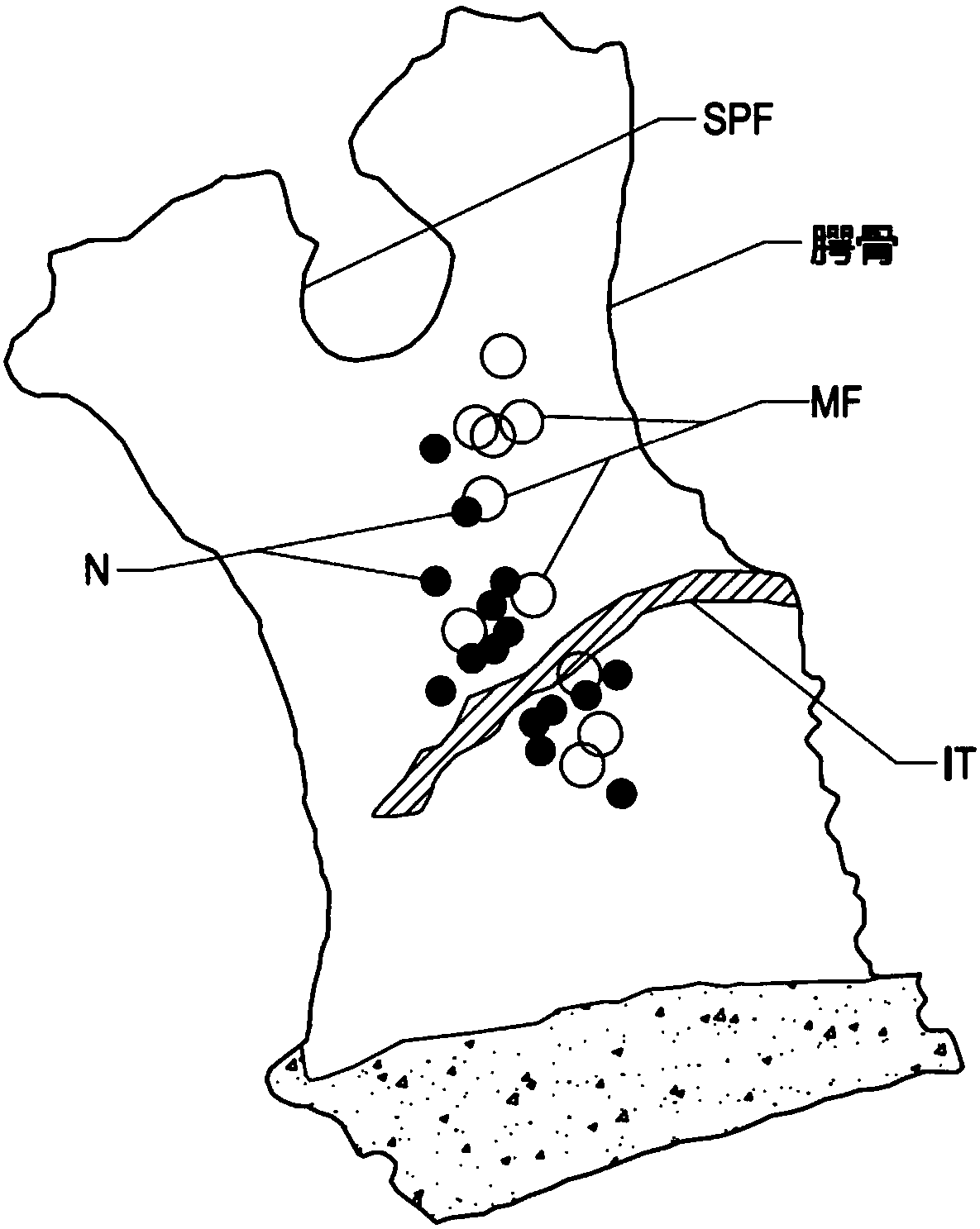 Devices for therapeutic nasal neuromodulation and associated methods and systems