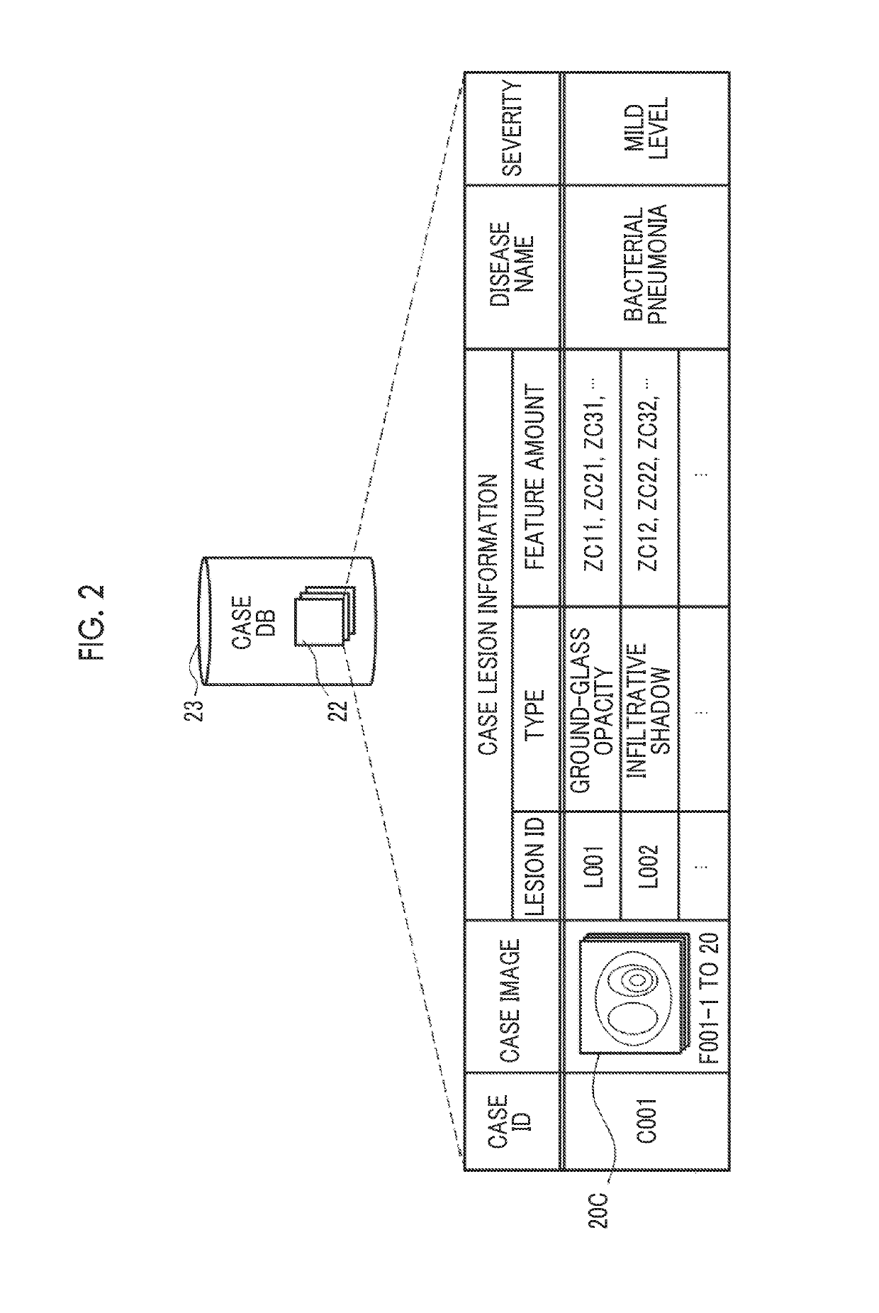 Similar case search apparatus, method for operating similar case search apparatus, and similar case search system