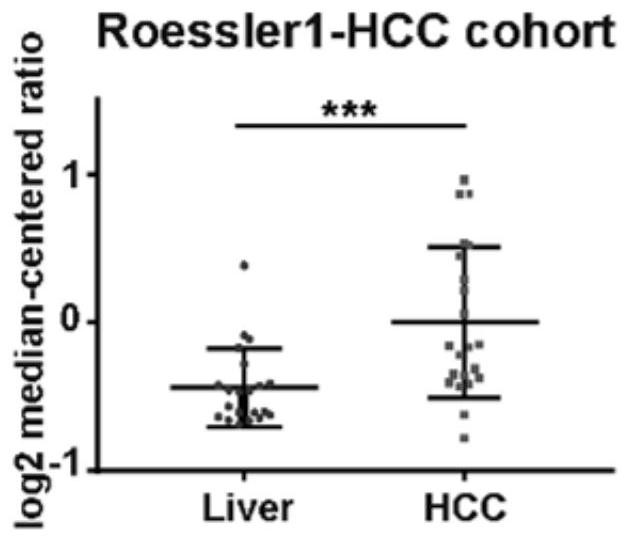 Application of INPP5F in preparation of medicine for prognosis, diagnosis or prevention and treatment of liver cancer tissue tumors