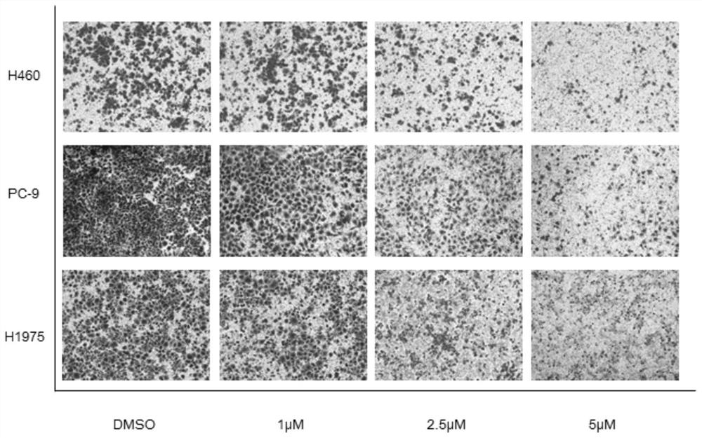 Application of withaferin A in preparation of antitumor drugs