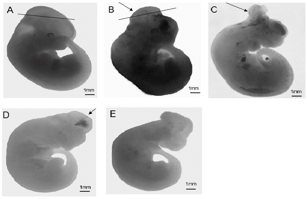 Application of thymidylate synthase inhibitor in preparation and construction of mouse model with NTDs (neural tube defects)