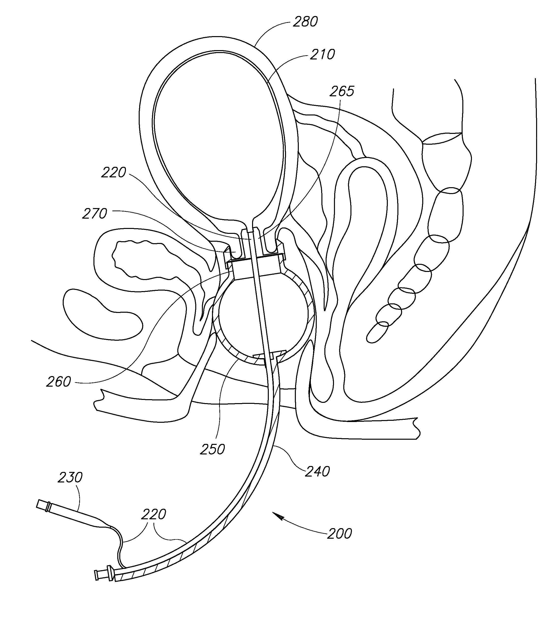 Surgical manipulation and occlusion device