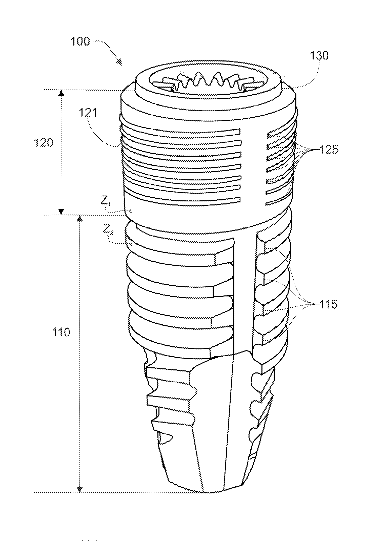 Endosseous implant and method for production thereof