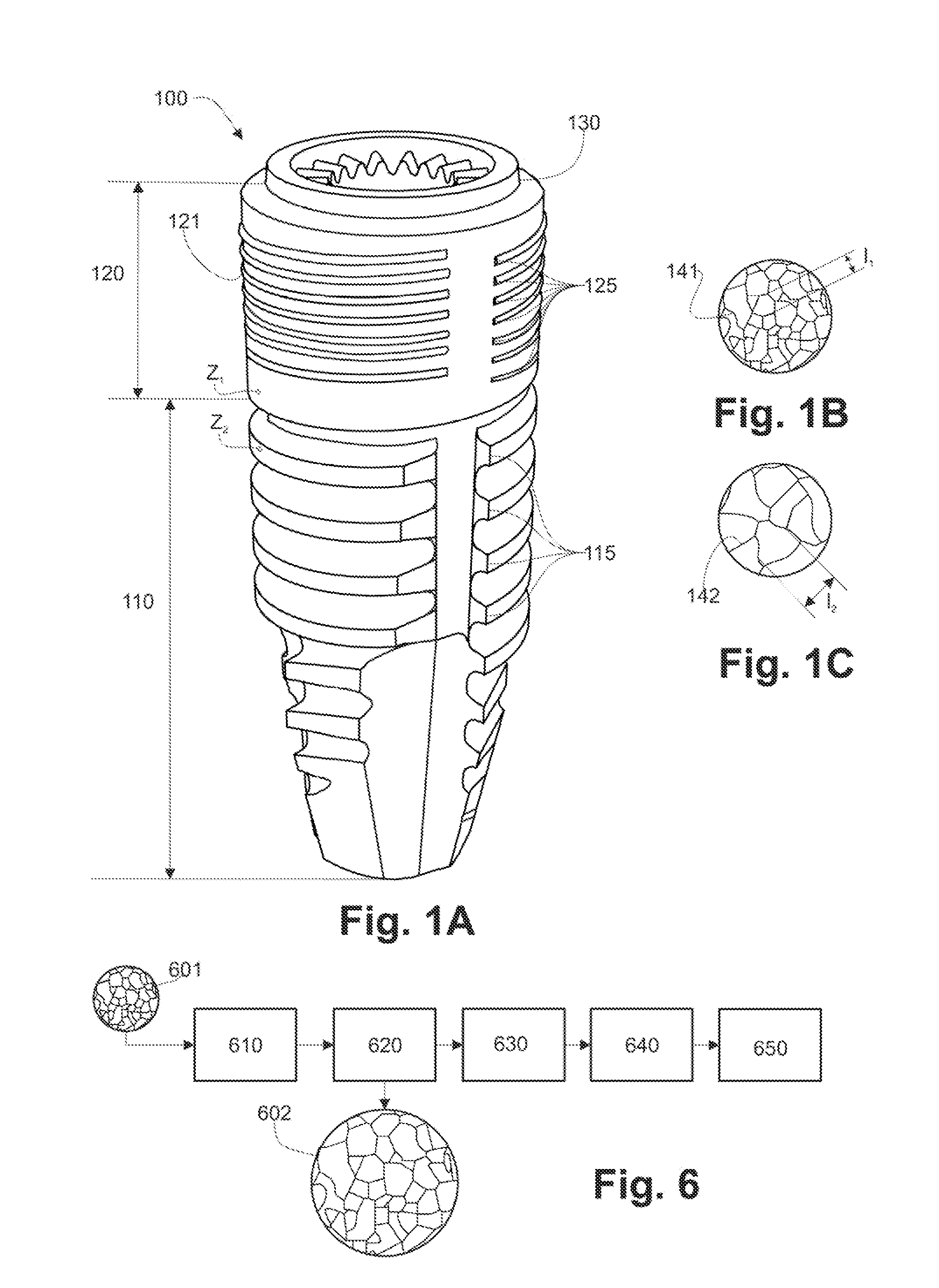 Endosseous implant and method for production thereof