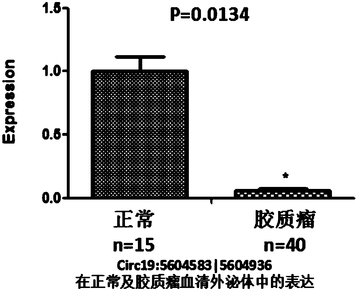 Glioma diagnostic marker Circ19:5604583|5604936 and application