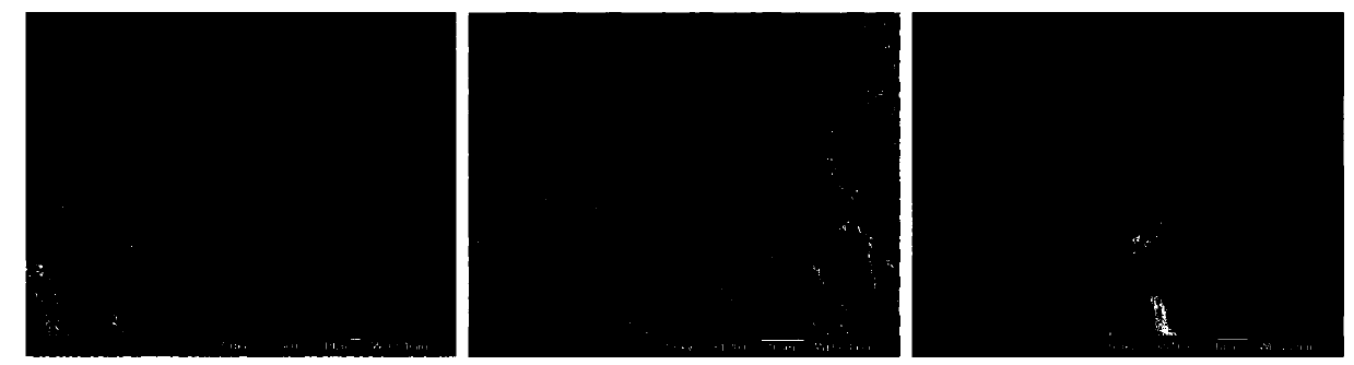 Polyethylene glycol based hydrogel and preparation method and application thereof