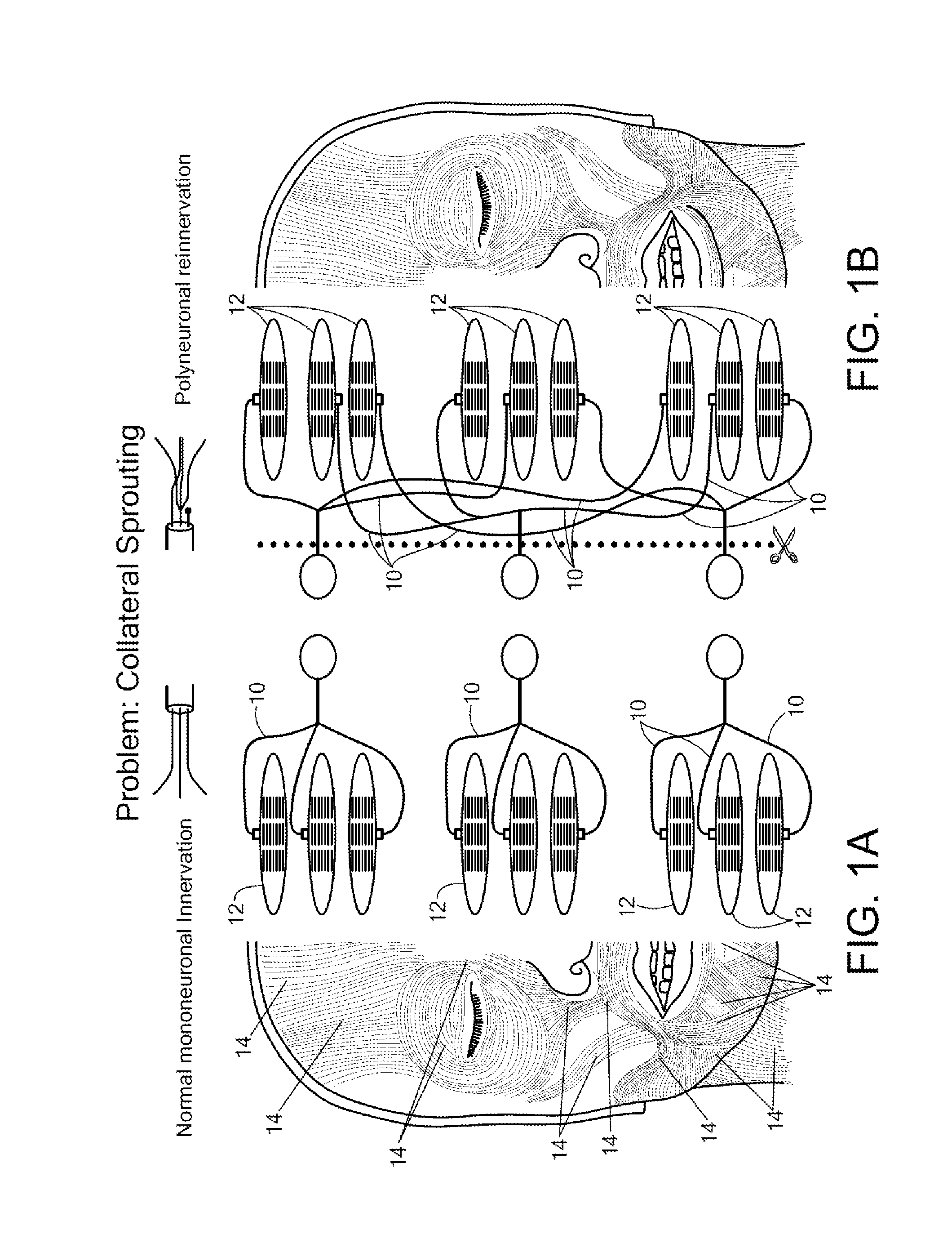 System and Method for Eyelid Simulation