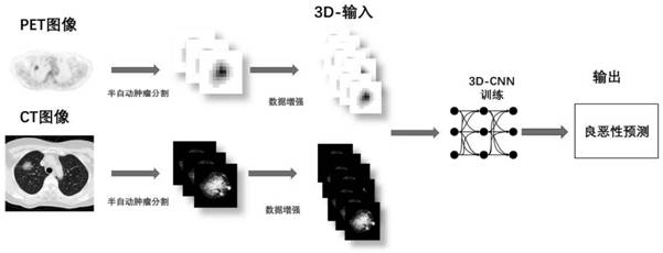 Ground glass nodule benign and malignant classification method based on two-way three-dimensional convolutional neural network