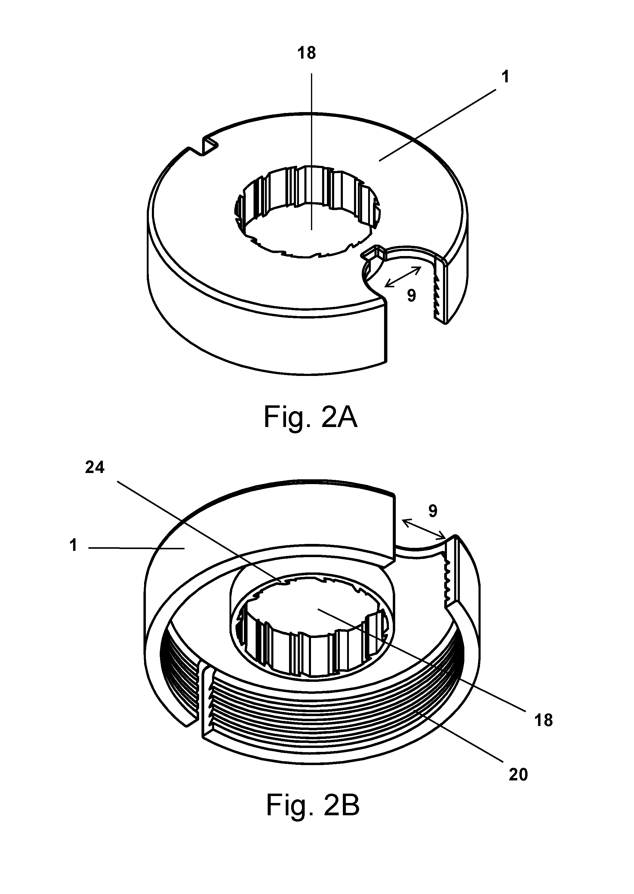 Soft Tissue Tensioning and Fixation Device