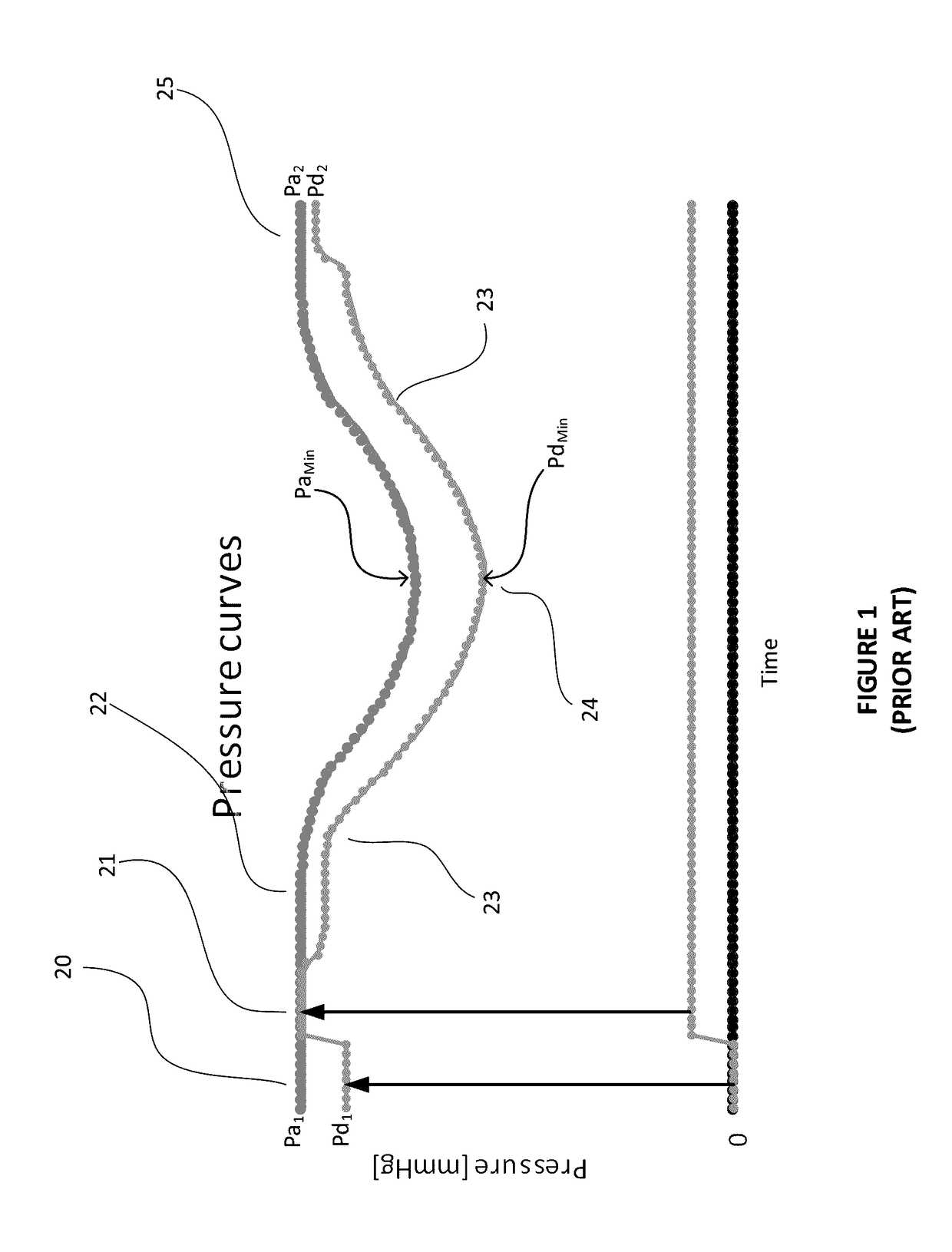 Method for pressure guidewire equalization