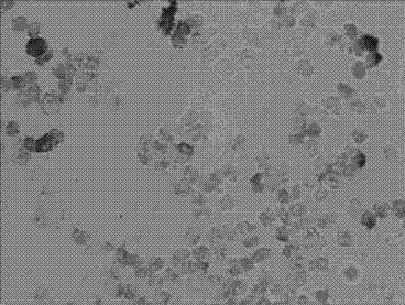 mRNA (Messenger Ribose Nucleic Acid) horizontal in-situ hybridization detection kit of PTEN and PHLPP1 at early stage of prostate canceration and detection method and application thereof