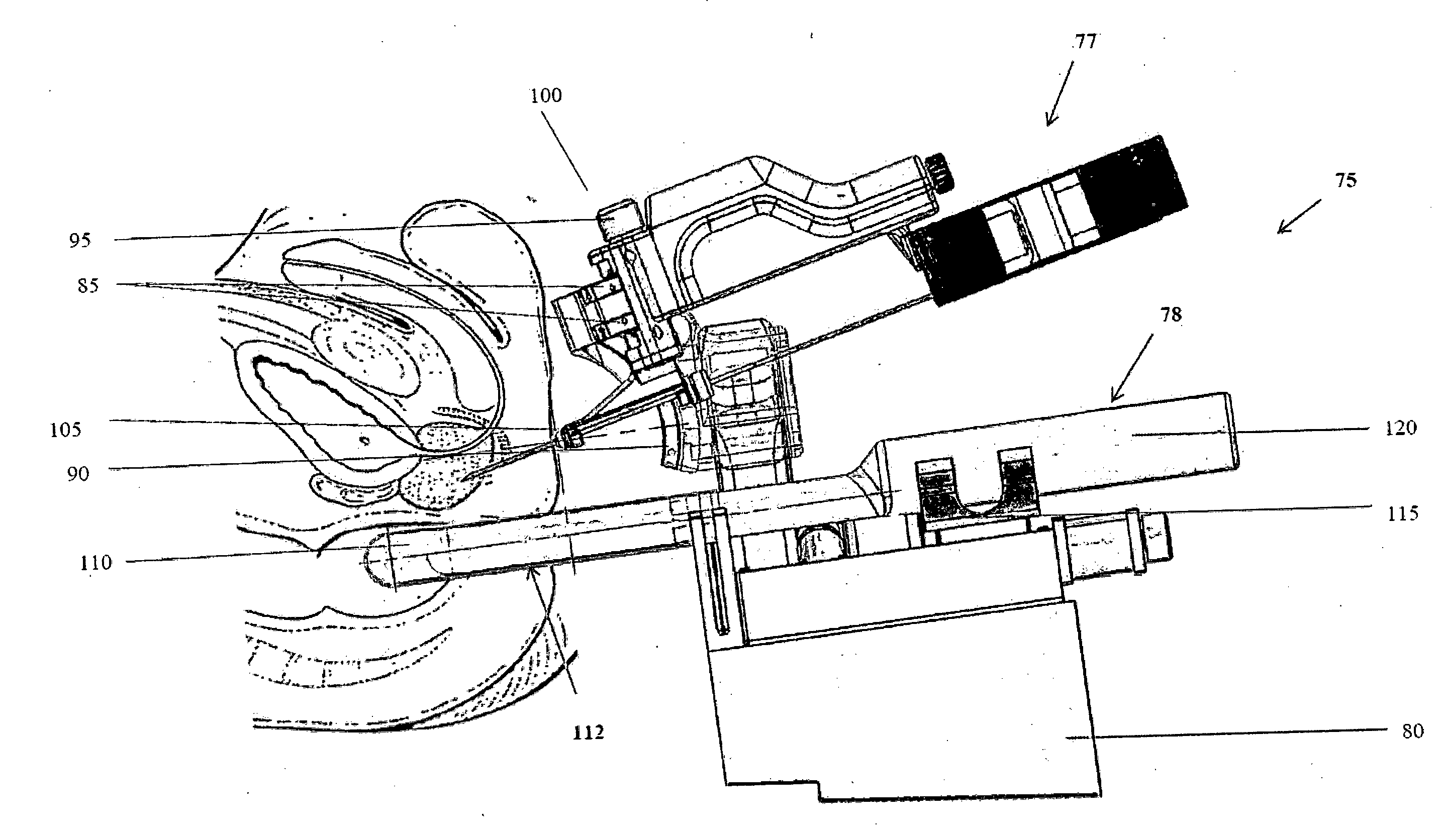 An apparatus and method for biopsy and therapy