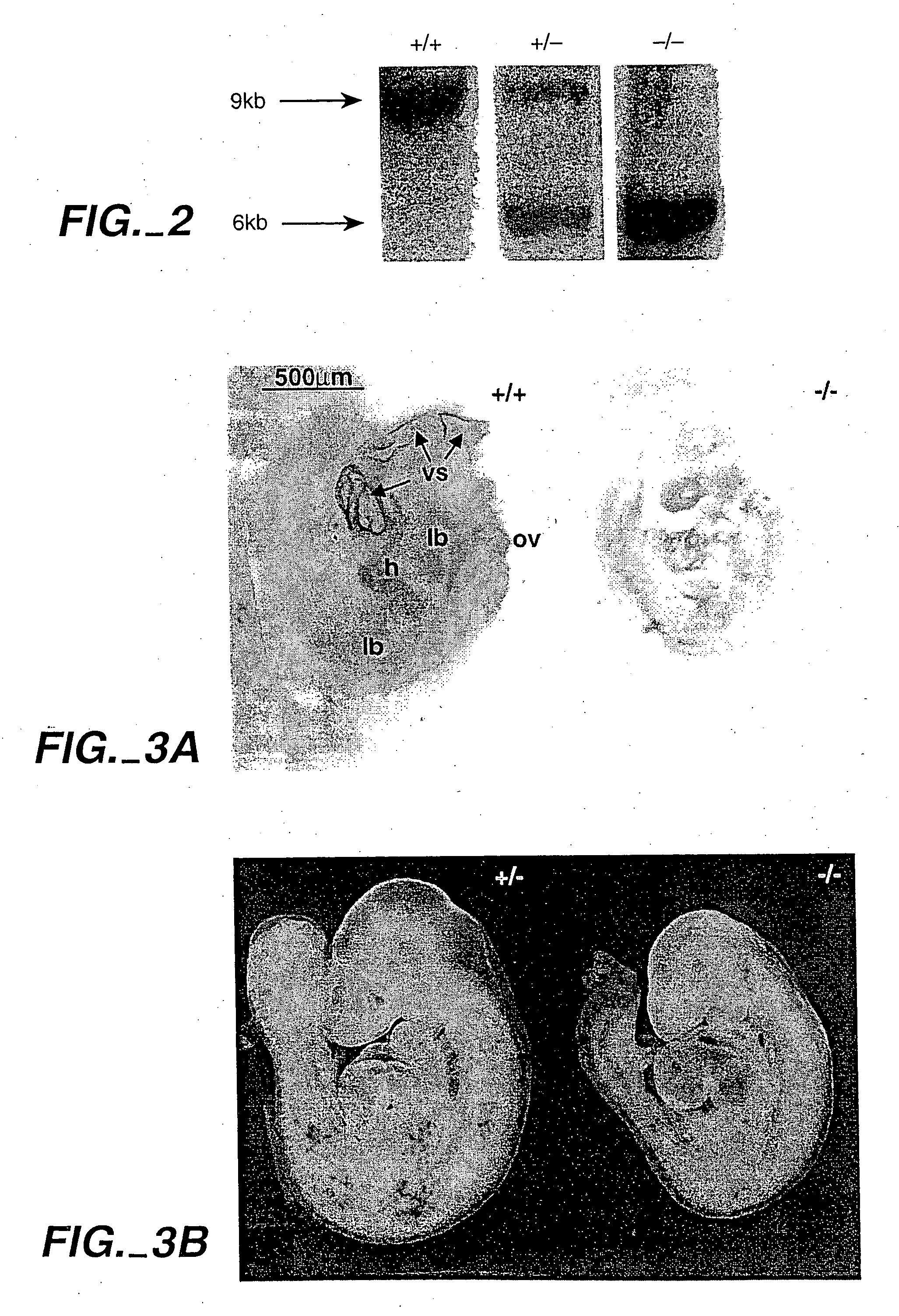 Methods for inhibiting angiogenesis by EphB receptor antagonists