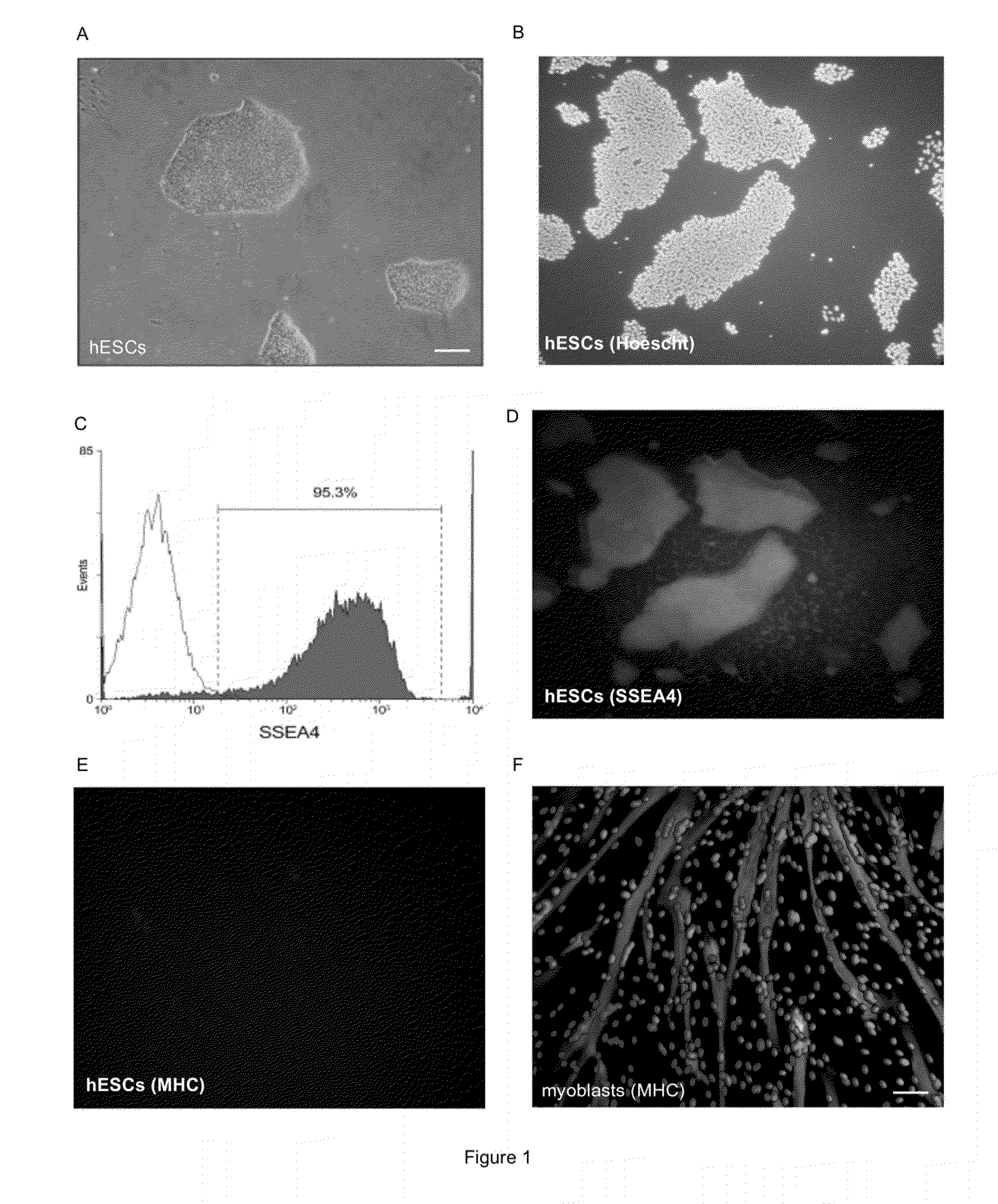 Myogenic differentiation of stem cells and and uses thereof