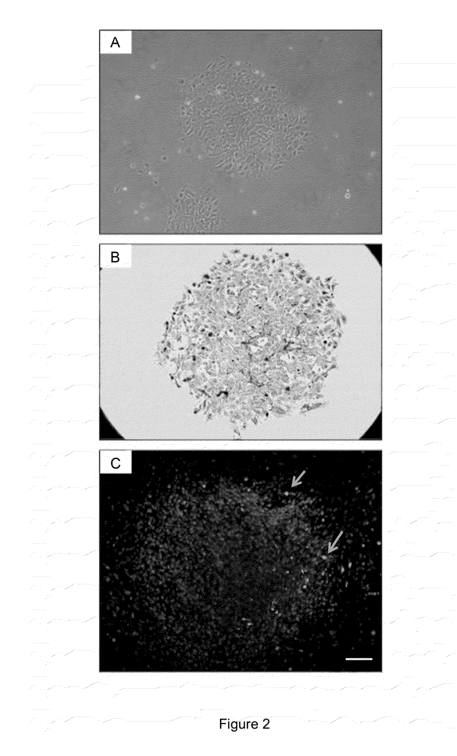 Myogenic differentiation of stem cells and and uses thereof