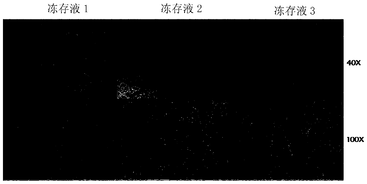 Serum-free cell cryopreservation solution as well as preparation method and application thereof