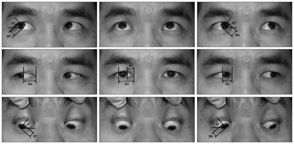 Eyeball motion segmentation positioning method based on cyclic residual convolutional neural network