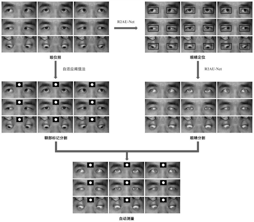 Eyeball motion segmentation positioning method based on cyclic residual convolutional neural network