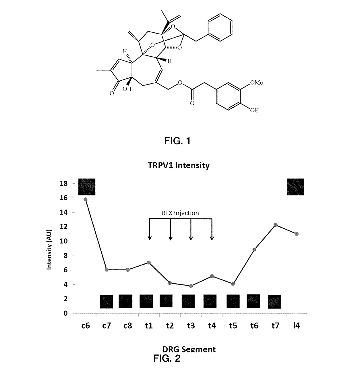 Methods for administration and methods for treating cardiovascular diseases with resiniferatoxin