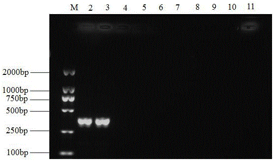 Molecular detection primer for banana cladosporium cucumerinum and detection method