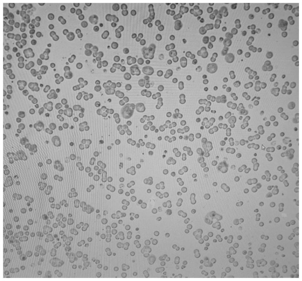 Preparation method for serum-free and suspension culture of HEK-293 cells and application of serum-free and suspension culture of HEK-293 cells