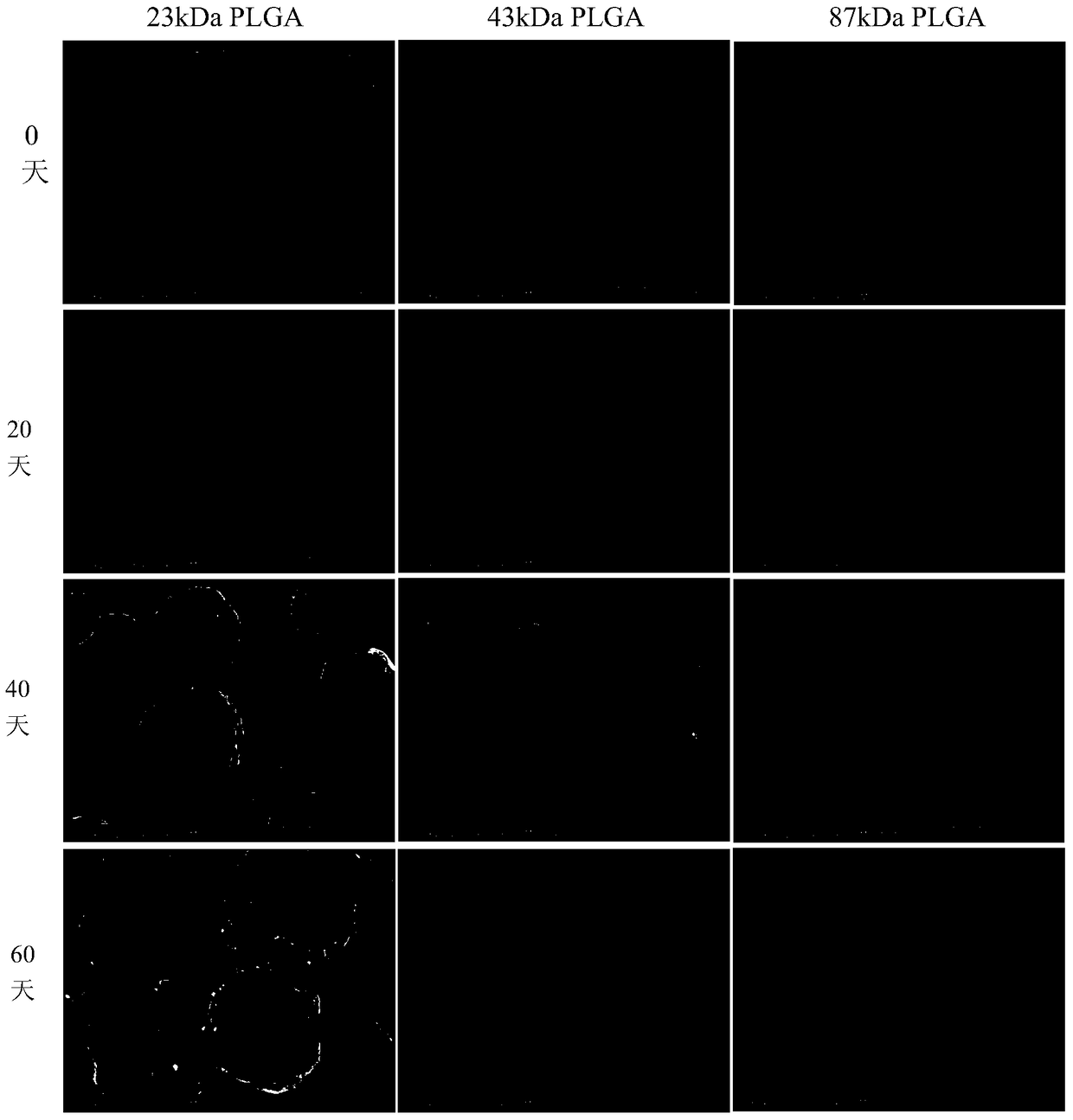 Sustained-release microsphere preparation containing recombinant hepatitis B surface antigen and preparation method thereof