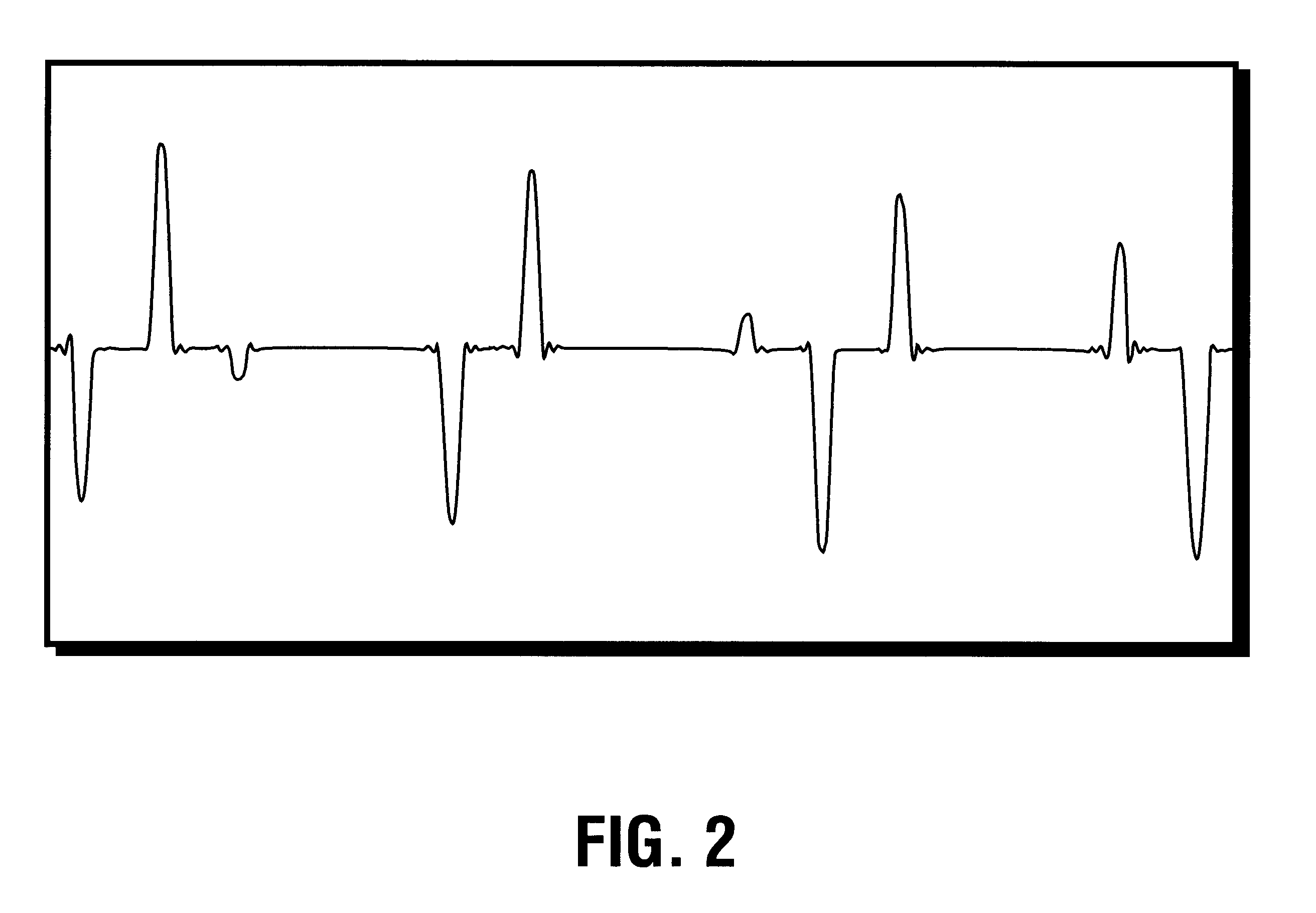 Controlling the peak levels of the FM composite signal by half-cosine interpolation