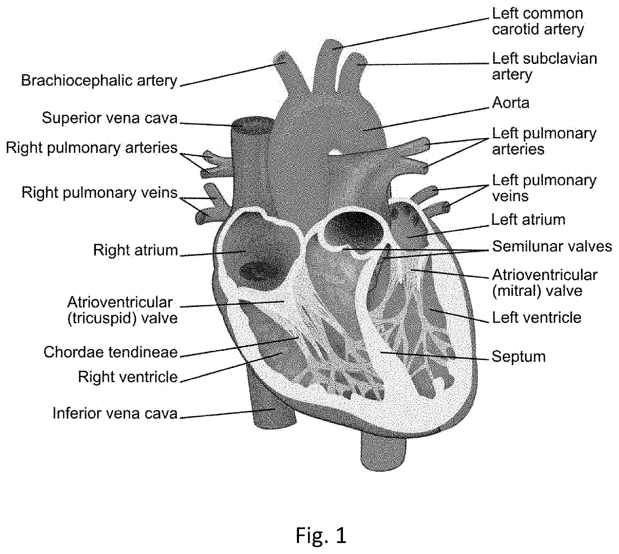 Transcatheter self-expandable tricuspid valve replacement system