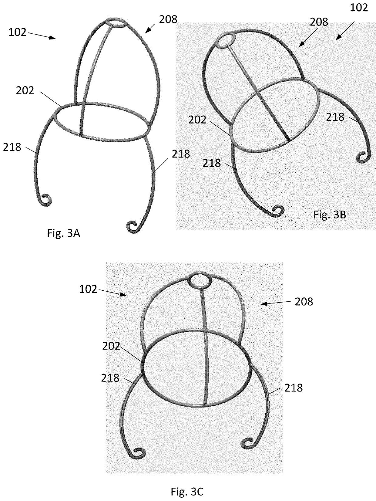 Transcatheter self-expandable tricuspid valve replacement system