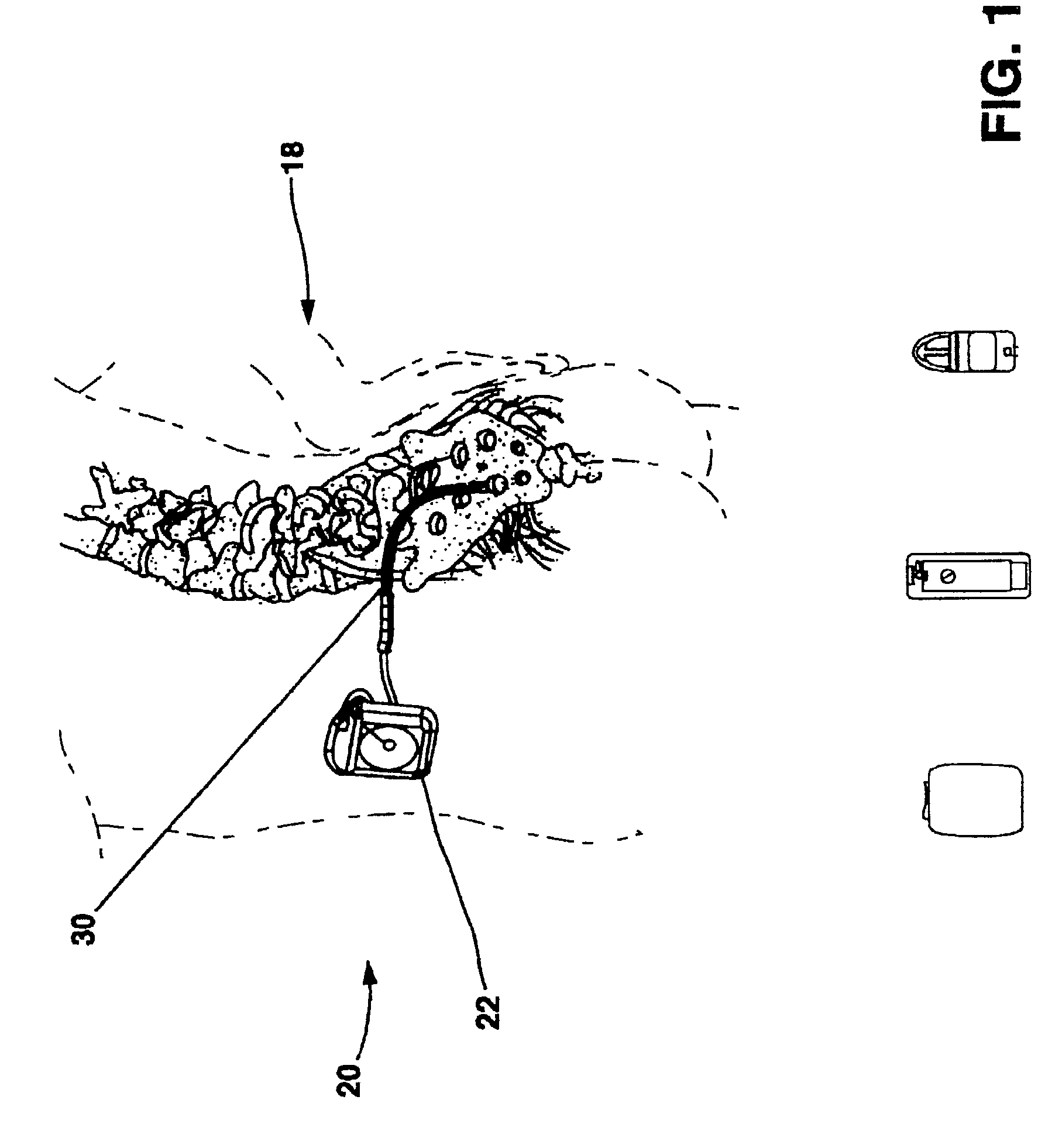 Method for performing a coplanar connection between a conductor and a contact on an implantable lead
