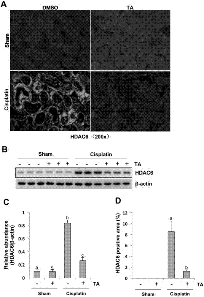Application of inhibitor of histone deacetylase HDAC 6 in preparing drugs for preventing and treating acute kidney injury