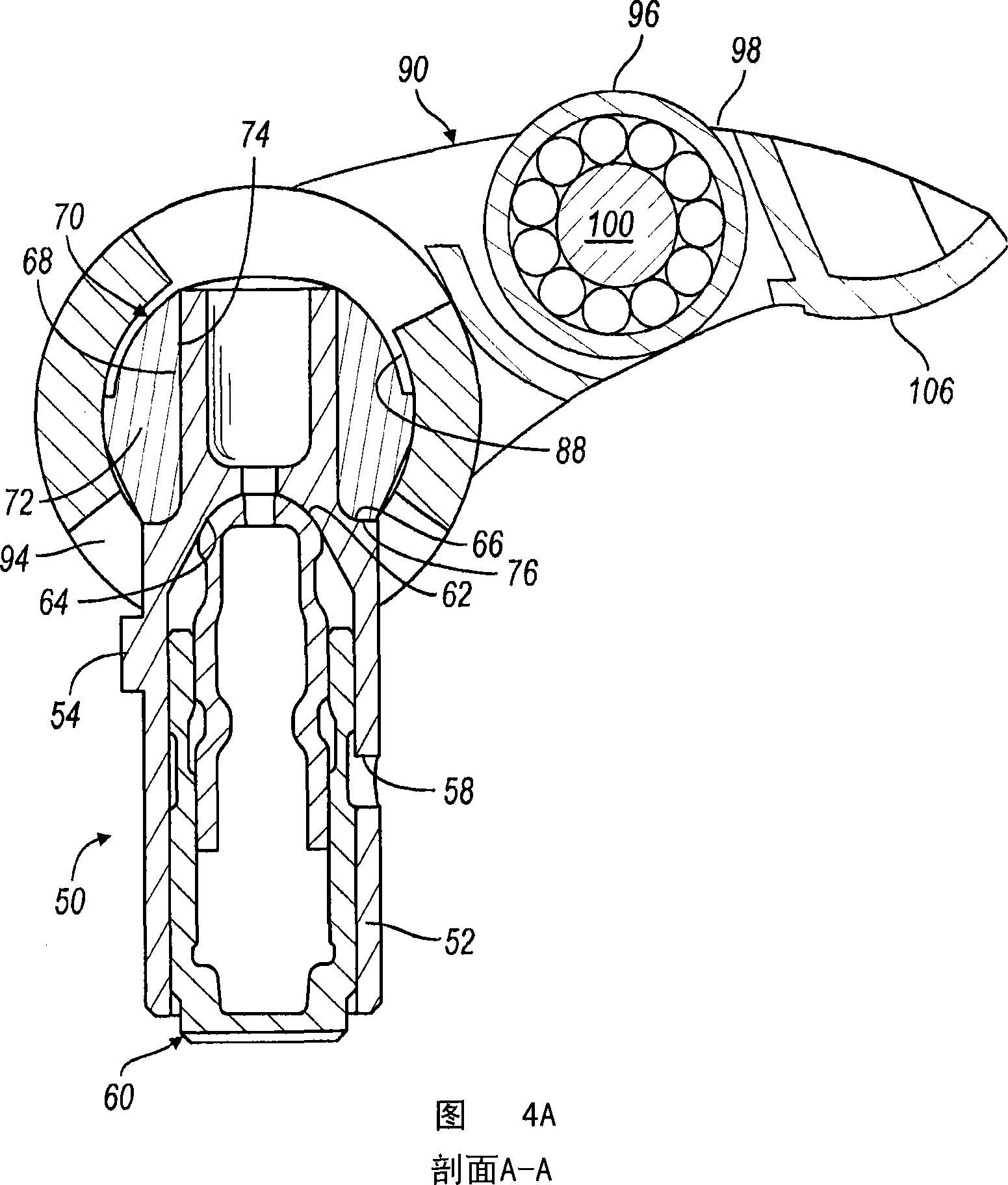 High performance overhead valvetrain assembly