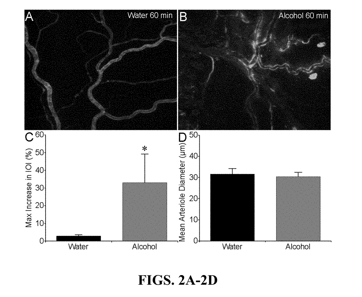 Stabilization of alcohol intoxication-induced cardiovascular instability