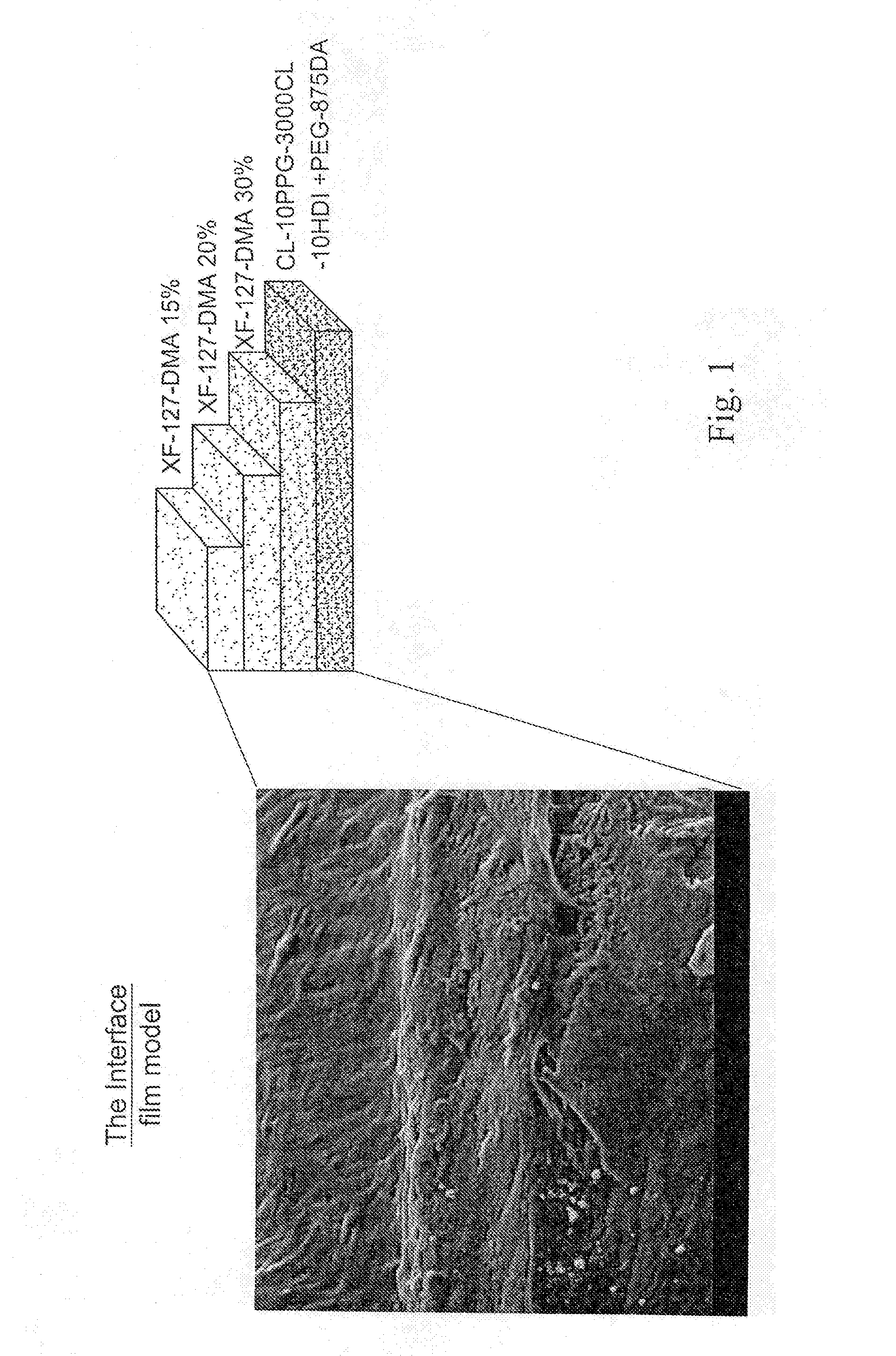 Ophthalmic viscosurgical device