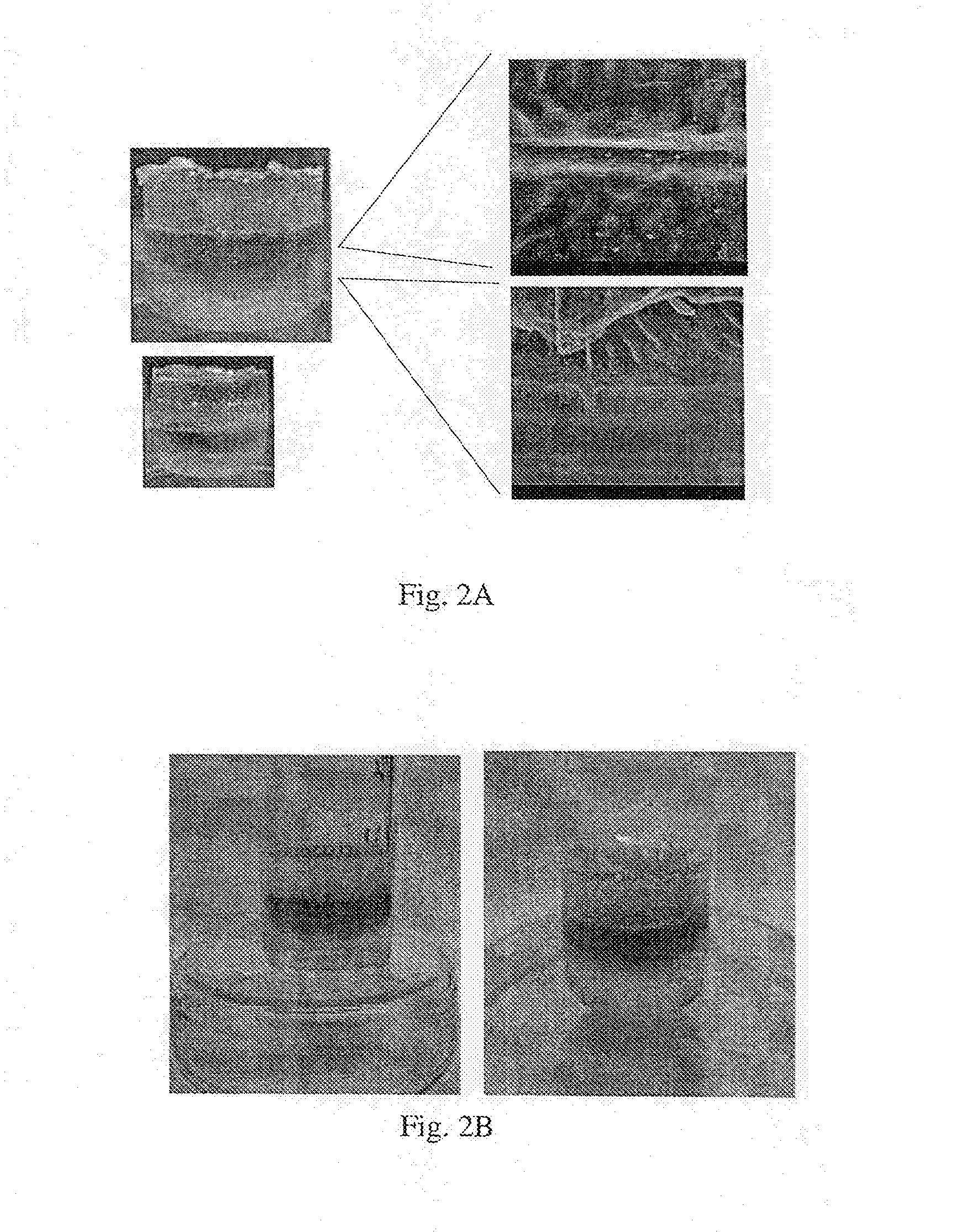 Ophthalmic viscosurgical device