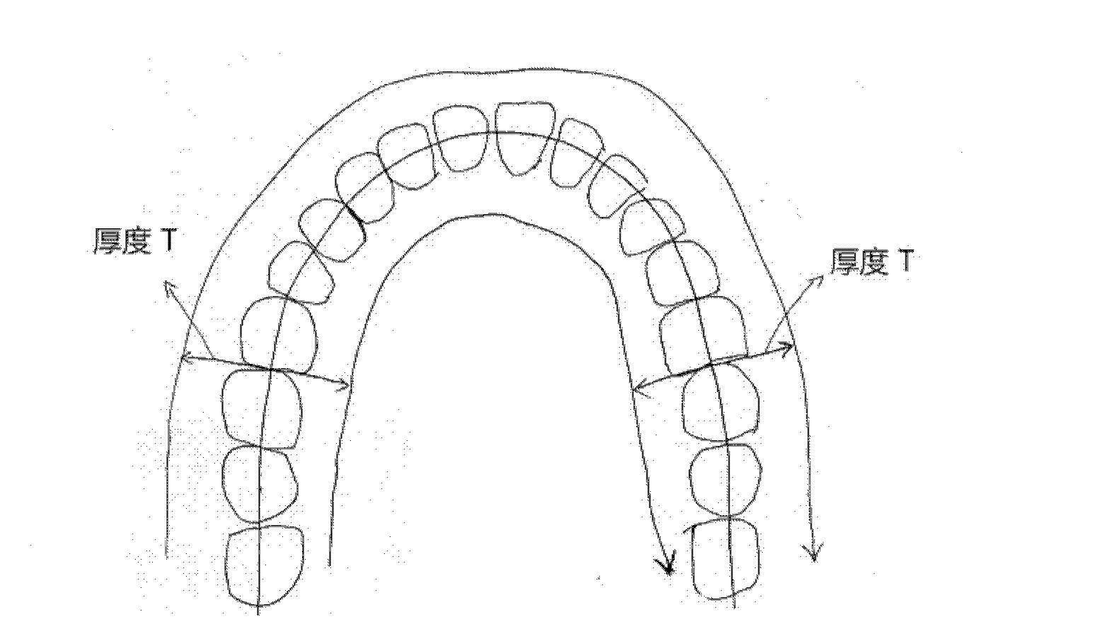 Data processing method of panoramagram generated by dental CBCT (cone beam computed tomography)