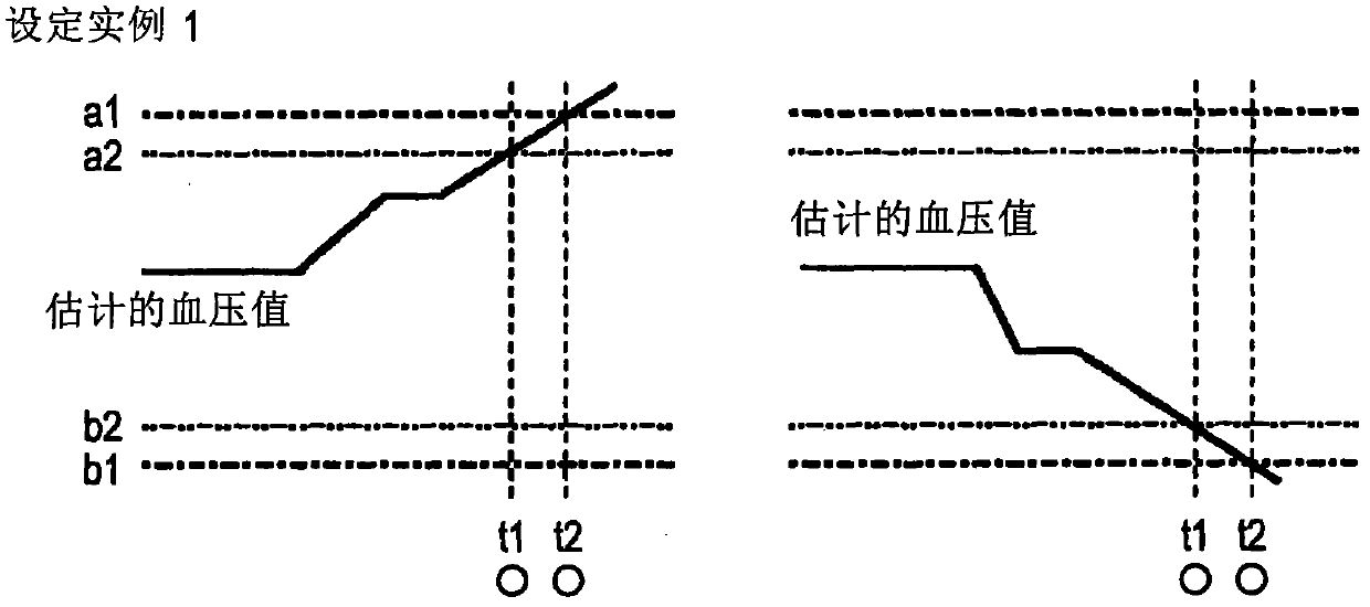 Biological information monitor