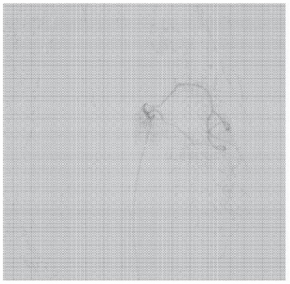 Radioactive microshperes for the treatment of CNS tumours