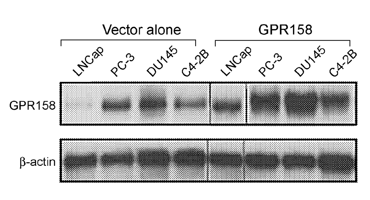 Biotherapeutics targeting gpr158 for cancer