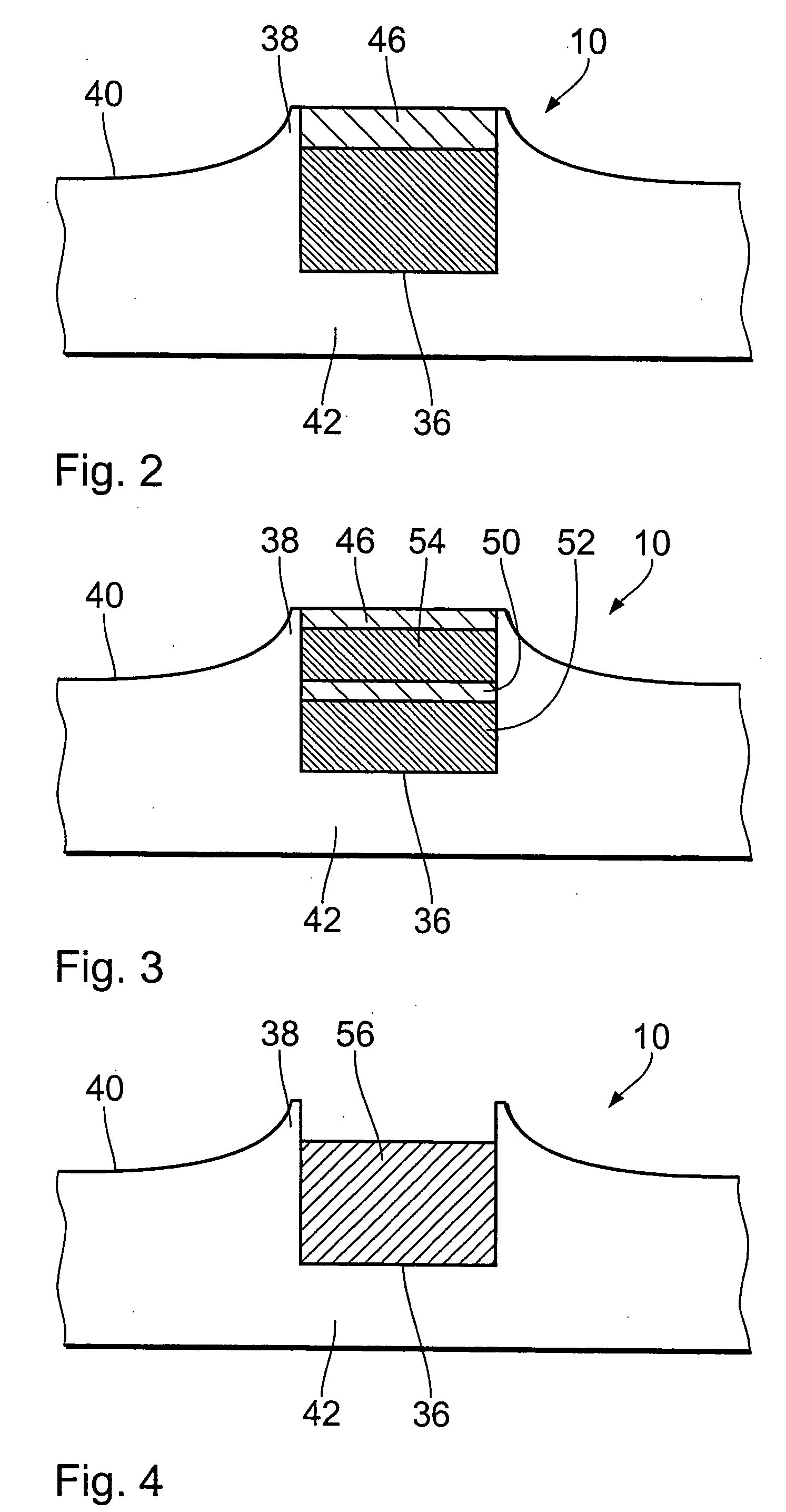 Endovascular implant for the injection of an active substance into the media of a blood vessel