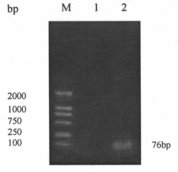 Method for quickly detecting duck viral enteritis by real-time fluorescence quantitative PCR and kit thereof