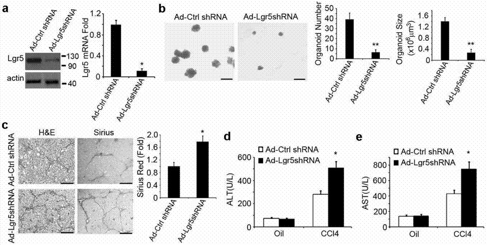 Induction method of Lgr5&lt;+&gt; (leucine-rich repeat-containing g-protein coupled receptor 5&lt;+&gt;) hepatic stem cells, and application thereof in detection