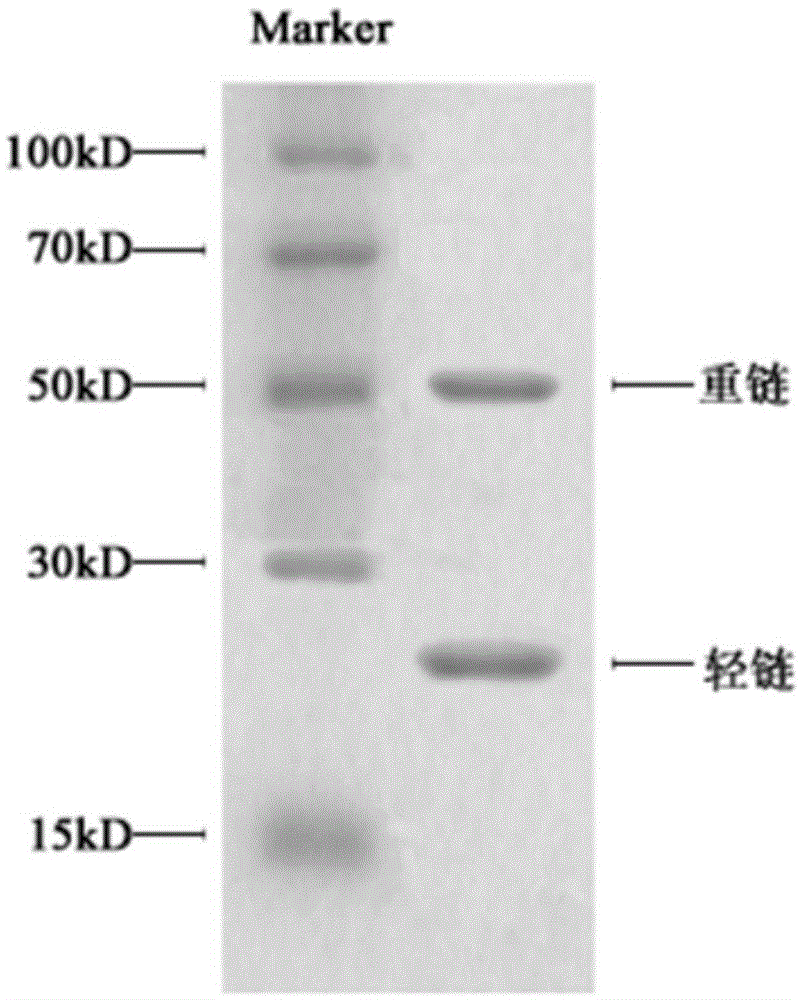 Polyclonal antibody of GXM (glucuronoxylomannan) of Cryptococcus neoformans and preparation method of polyclonal antibody